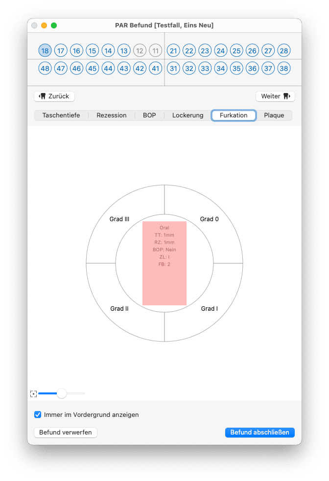 tomedo handbuch dental PAR Befund Messung Furkationsbefall