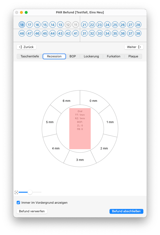 tomedo handbuch dental PAR Befund Messung Rezession