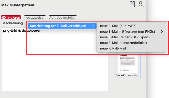 E Mails versenden in Vidierliste