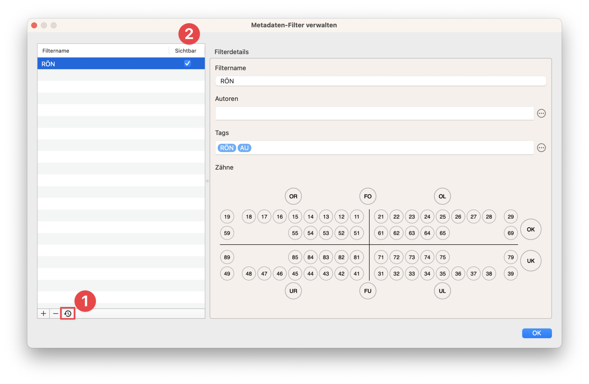 Ablage Quiz konfigurierbare Filter Verundung 3