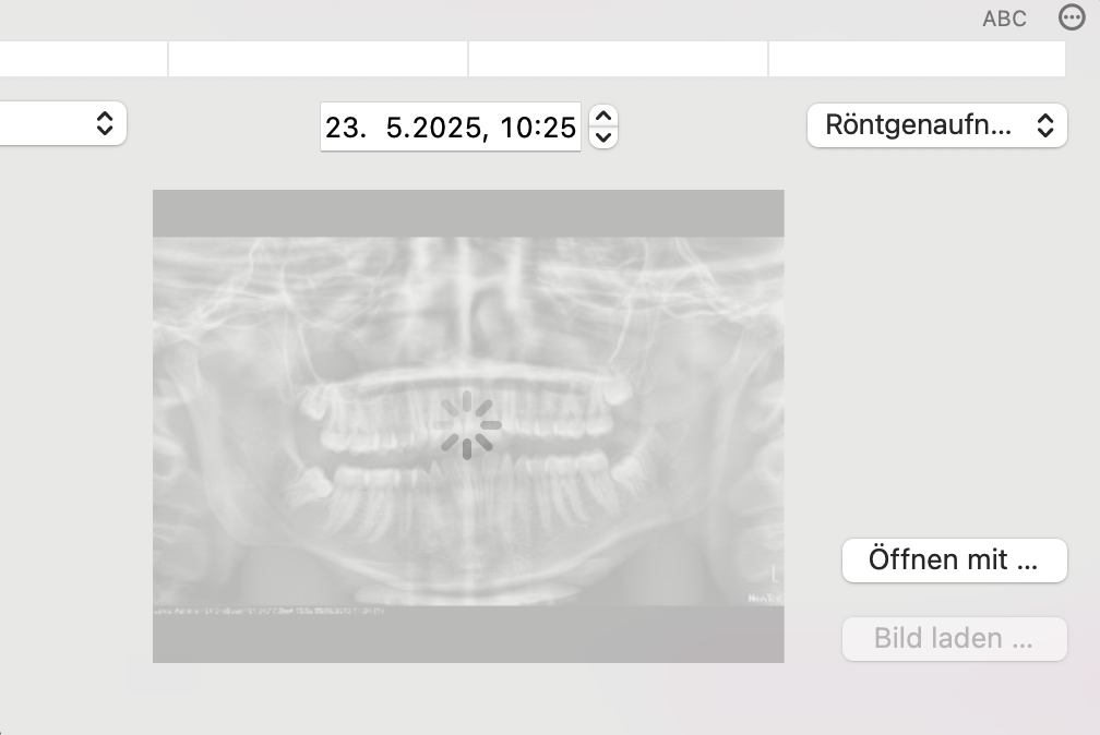 tomedo changelog v1 156 Roentgenbild laden