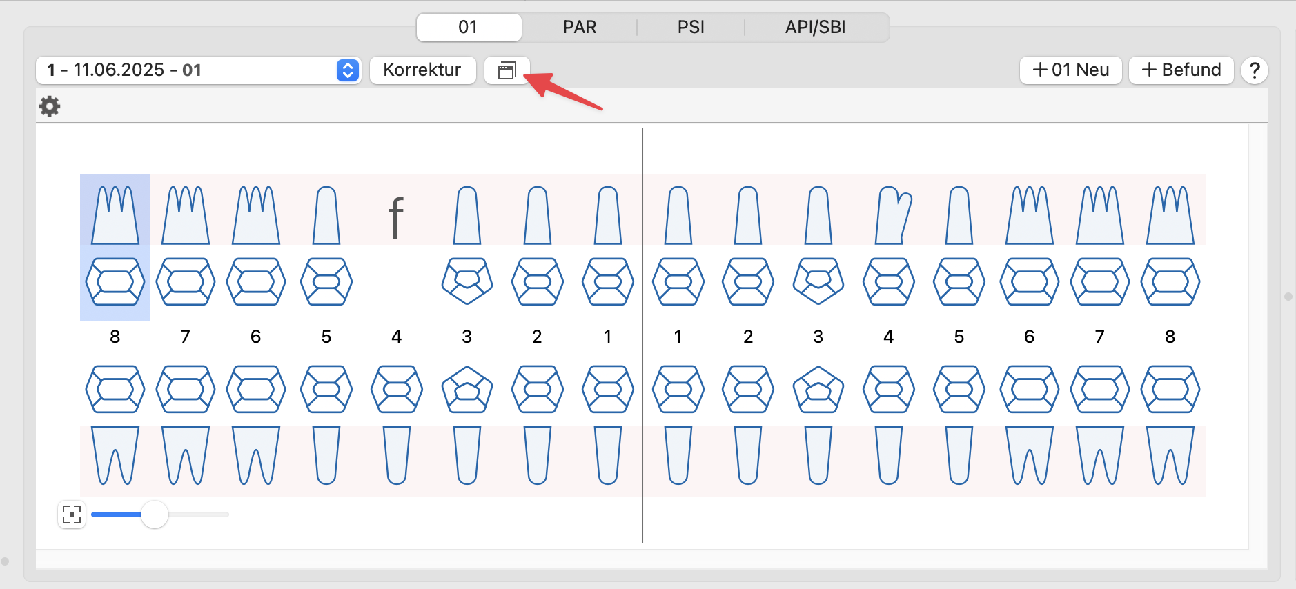 tomedo changelog v1 156 separater 01 Befund