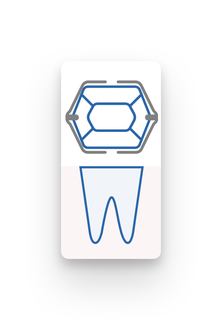 tomedo handbuch Fachgruppen Dental 01 Befund Kuerzel Klammer